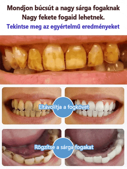 💥Super Probiotic-4 fogkrém 6 probiotikummal oalance Oral mikrobióta erőssége