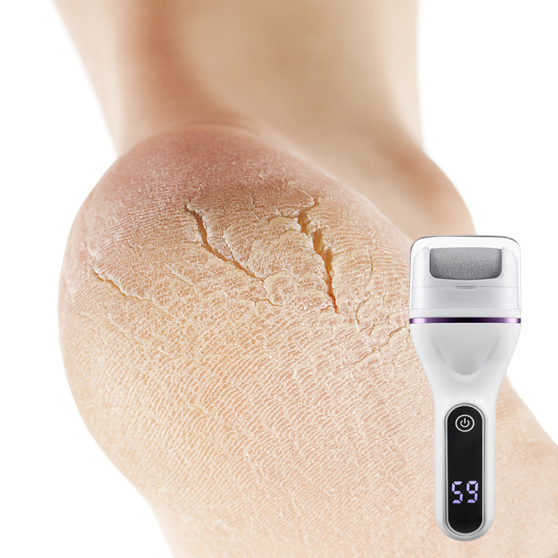 Hordozható elektromos lábkeményedés-eltávolító